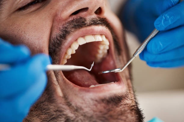 Best Emergency Tooth Extraction in Breckenridge, MI